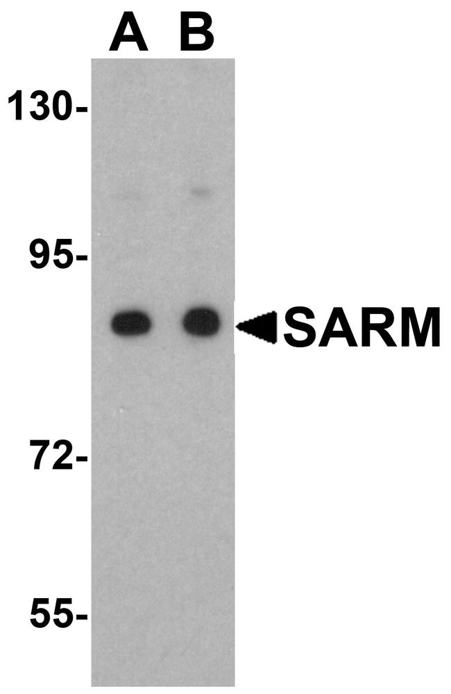 SARM Antibody in Western Blot (WB)