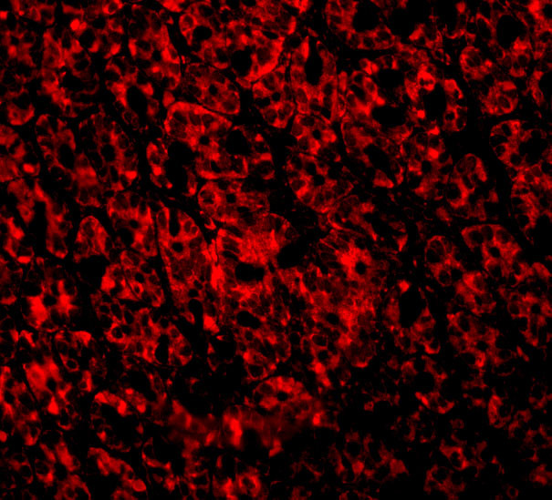ARMER Antibody in Immunocytochemistry (ICC/IF)