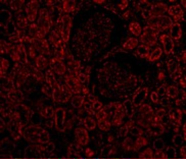 Bcl-2 Antibody in Immunocytochemistry (ICC/IF)