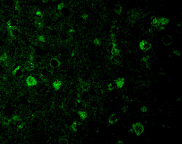 RHEB Antibody in Immunocytochemistry (ICC/IF)