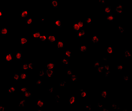 RSK1 Antibody in Immunocytochemistry (ICC/IF)