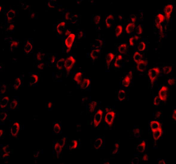 CTRP4 Antibody in Immunocytochemistry (ICC/IF)