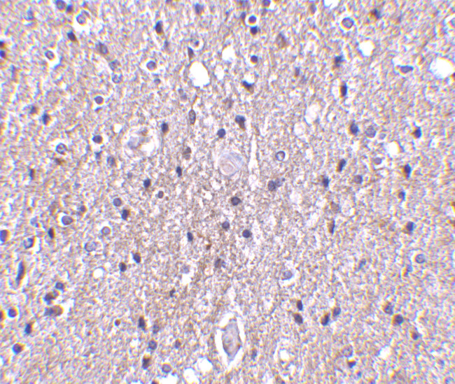 CTRP4 Antibody in Immunohistochemistry (IHC)