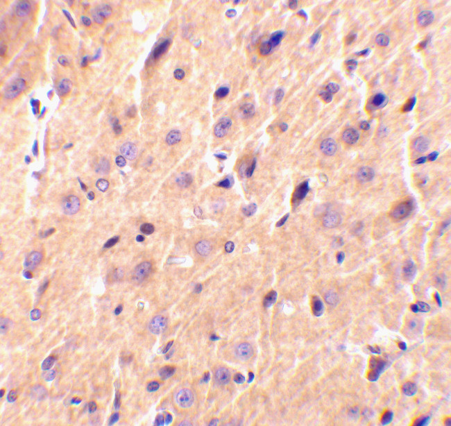 Precerebellin Antibody in Immunohistochemistry (IHC)