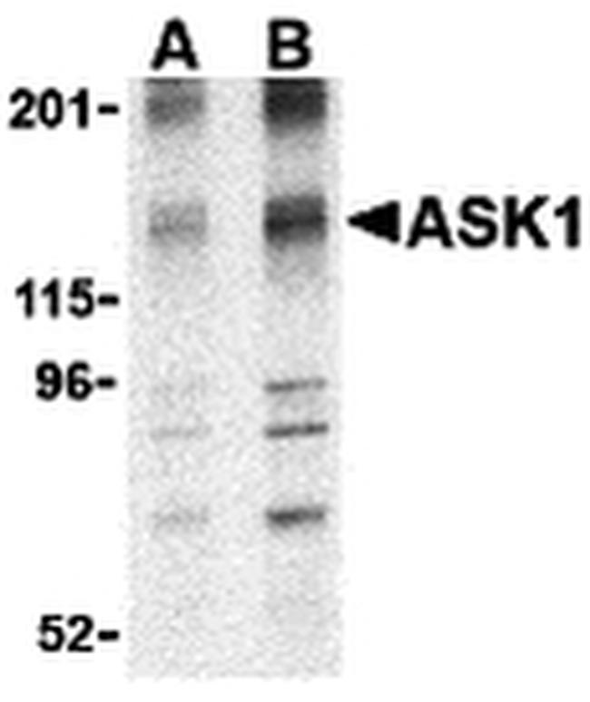 ASK1 Antibody in Western Blot (WB)