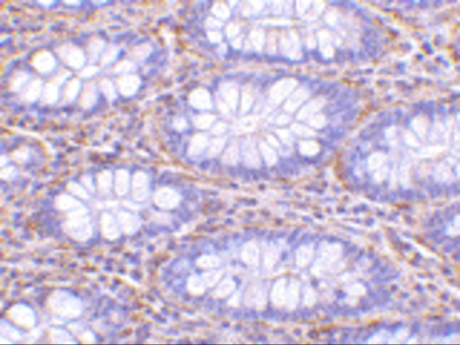 PAK4 Antibody in Immunohistochemistry (IHC)