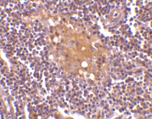 AIM Antibody in Immunohistochemistry (IHC)