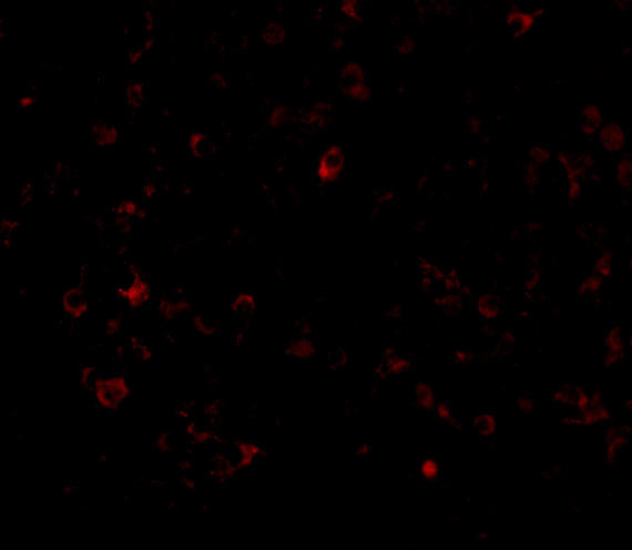 AIM Antibody in Immunocytochemistry (ICC/IF)