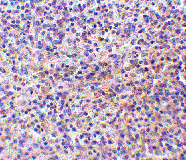 CD180 Antibody in Immunohistochemistry (IHC)