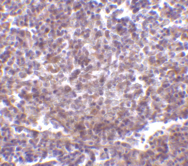 CD180 Antibody in Immunohistochemistry (IHC)