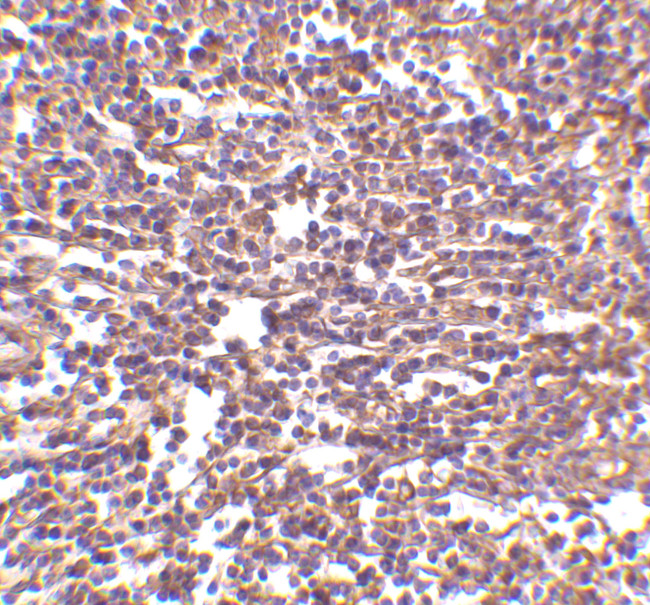 CD180 Antibody in Immunohistochemistry (IHC)