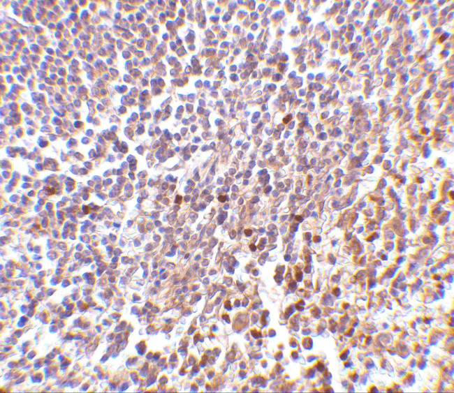 MD-1 Antibody in Immunohistochemistry (IHC)