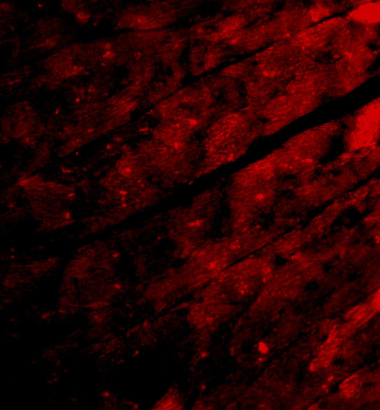 TRPC3 Antibody in Immunocytochemistry (ICC/IF)