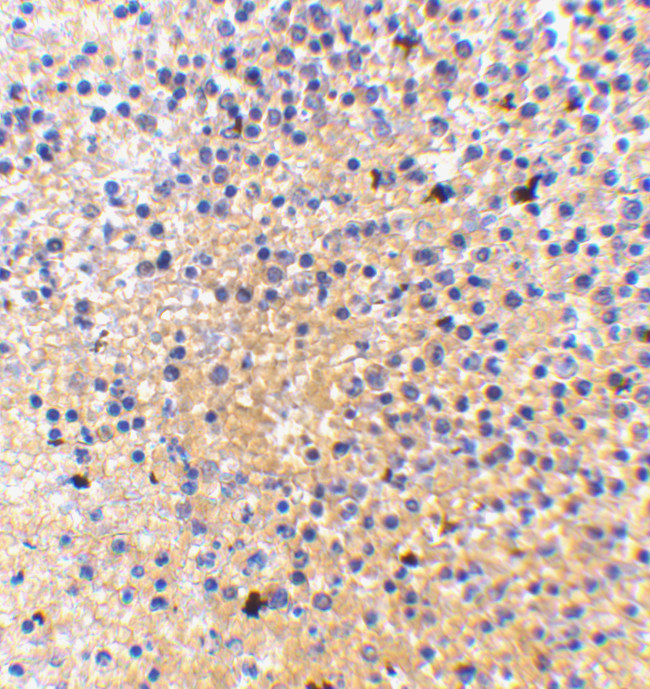 MD-1 Antibody in Immunohistochemistry (IHC)