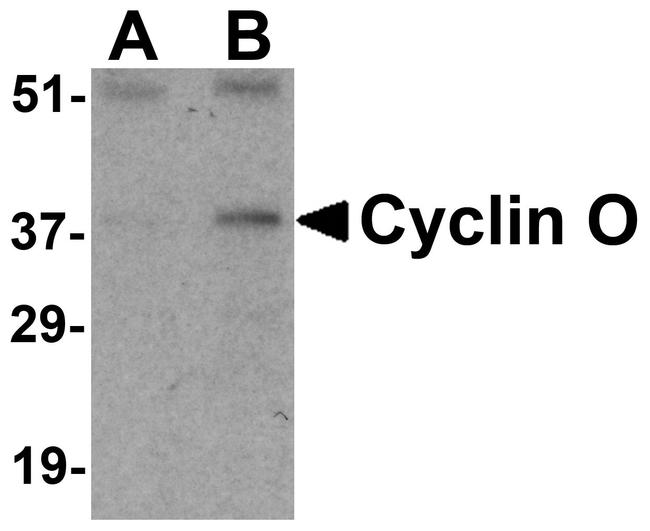 Cyclin O Antibody in Western Blot (WB)