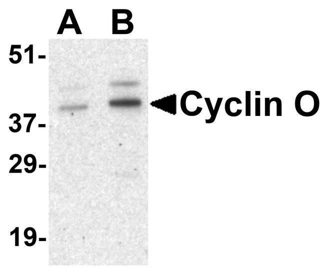 Cyclin O Antibody in Western Blot (WB)