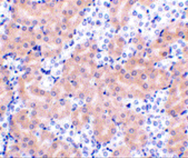 BCL2A1 Antibody in Immunohistochemistry (IHC)