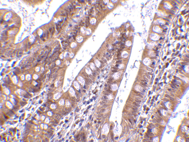 CIDEB Antibody in Immunohistochemistry (IHC)