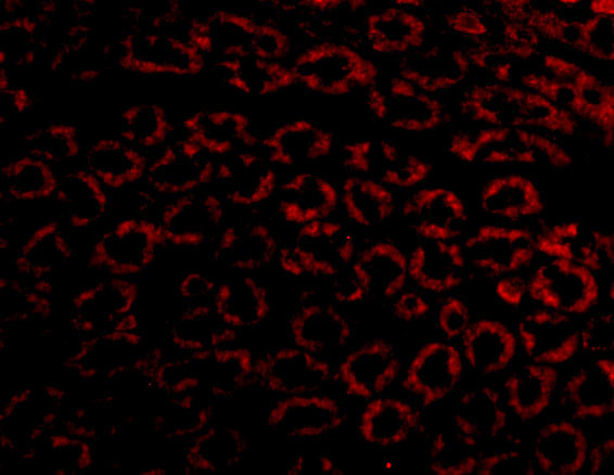Nephrin Antibody in Immunocytochemistry (ICC/IF)