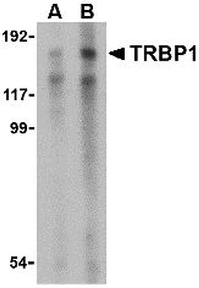 TRBP1 Antibody in Western Blot (WB)