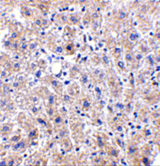 DRAM Antibody in Immunohistochemistry (Paraffin) (IHC (P))