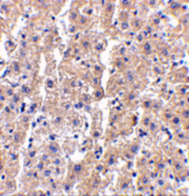DRAM Antibody in Immunohistochemistry (Paraffin) (IHC (P))