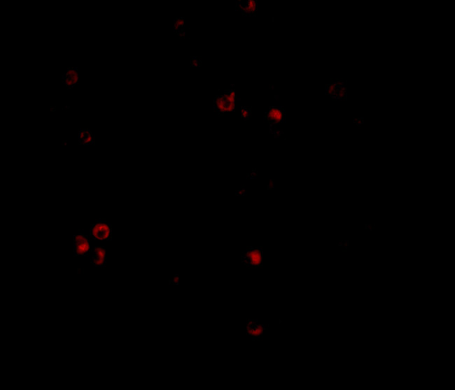 MDA5 Antibody in Immunocytochemistry (ICC/IF)