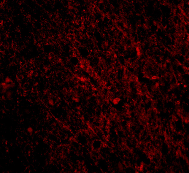 SCO1 Antibody in Immunocytochemistry (ICC/IF)