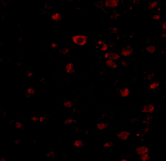 BRSK1 Antibody in Immunocytochemistry (ICC/IF)