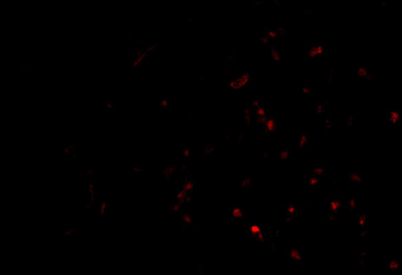 TEP1 Antibody in Immunocytochemistry (ICC/IF)