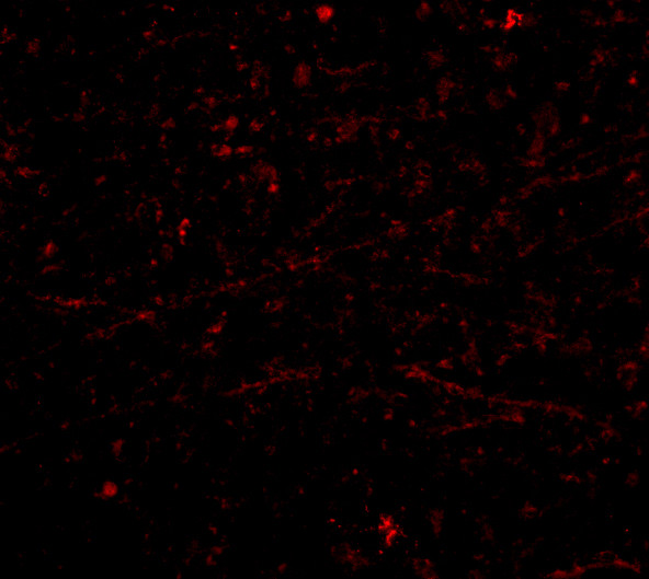 DARC Antibody in Immunocytochemistry (ICC/IF)