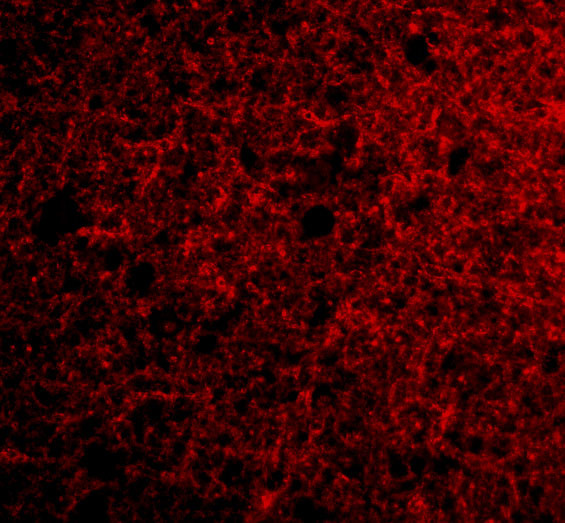Neurotrypsin Antibody in Immunocytochemistry (ICC/IF)