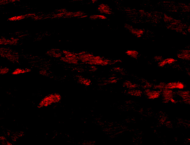 Neuritin Antibody in Immunocytochemistry (ICC/IF)
