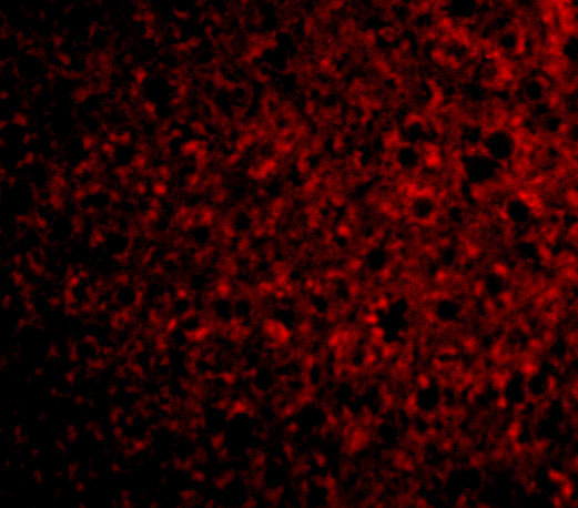 TSLP Receptor Antibody in Immunocytochemistry (ICC/IF)