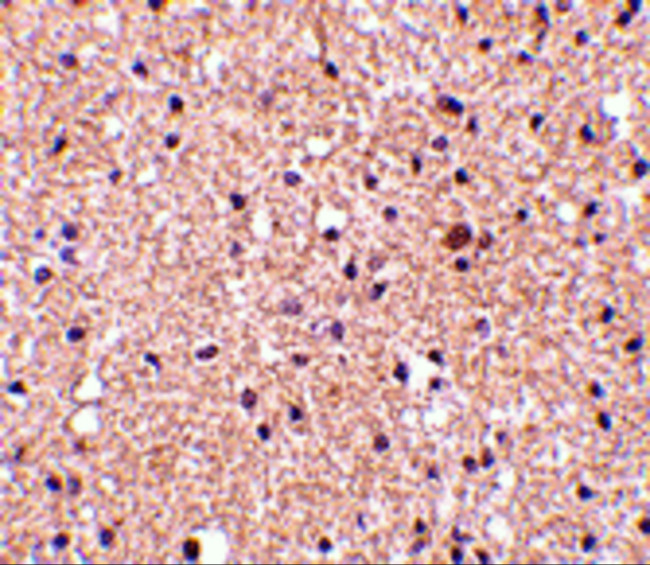 Stathmin 1 Antibody in Immunohistochemistry (Paraffin) (IHC (P))