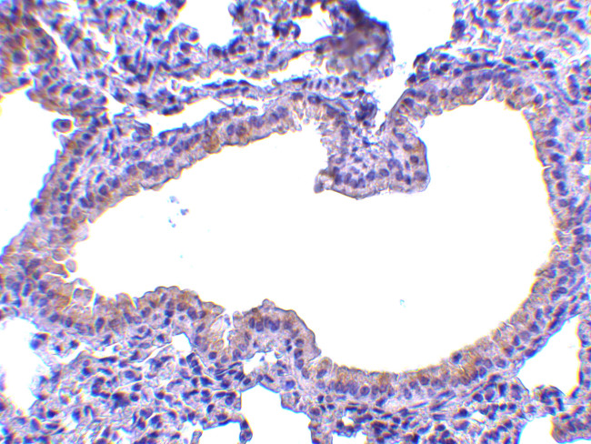 SLPI Antibody in Immunohistochemistry (IHC)