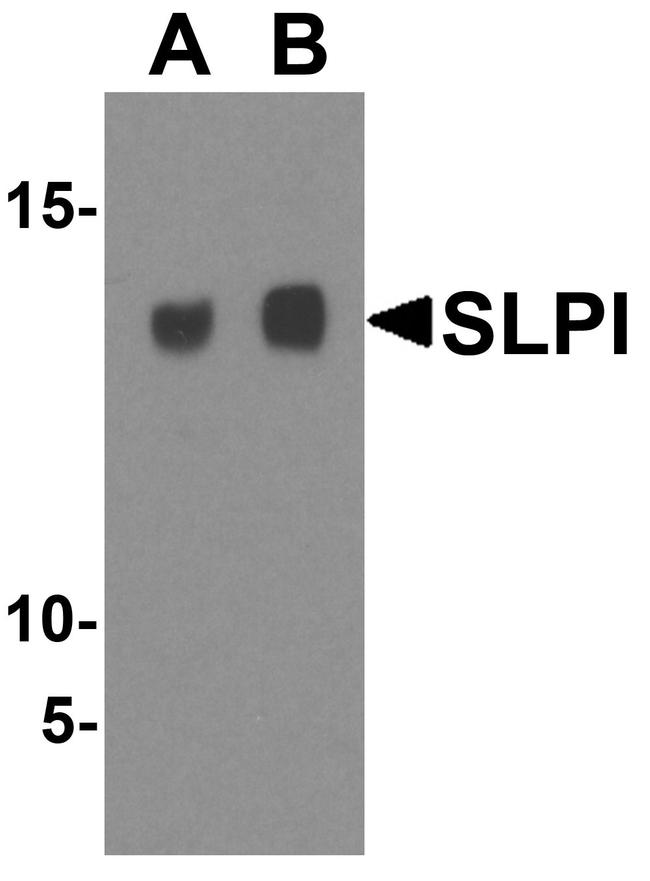 SLPI Antibody in Western Blot (WB)