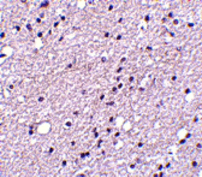 TACR3 Antibody in Immunohistochemistry (IHC)
