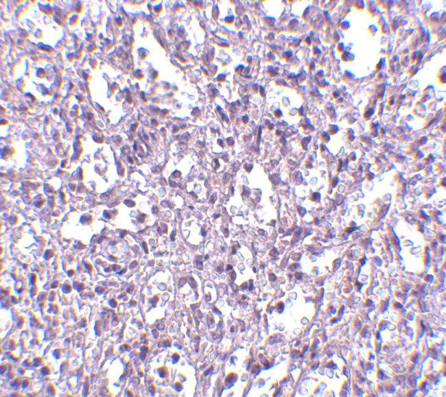 Carabin Antibody in Immunohistochemistry (IHC)