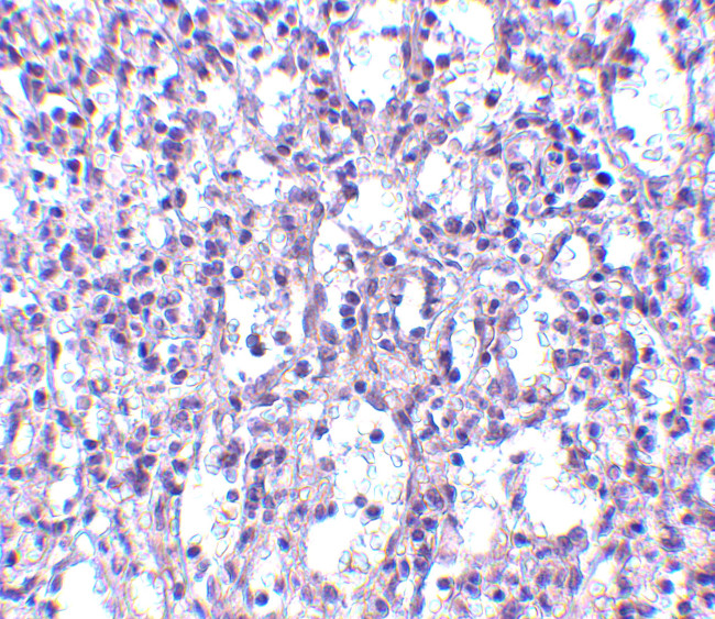 Carabin Antibody in Immunohistochemistry (IHC)