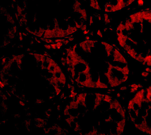 STEAP2 Antibody in Immunocytochemistry (ICC/IF)