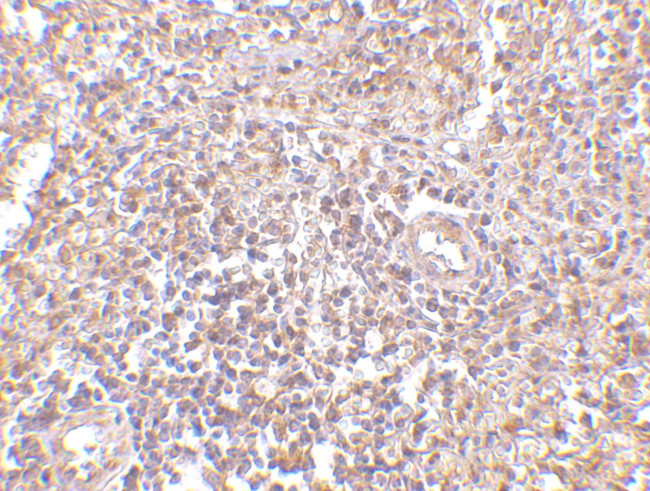 RAP80 Antibody in Immunohistochemistry (IHC)