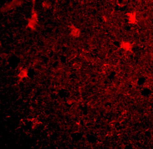 BRCC3 Antibody in Immunocytochemistry (ICC/IF)