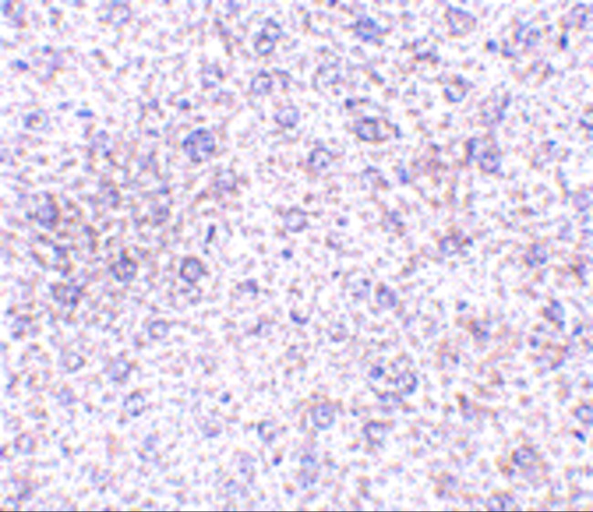 TEM7 Antibody in Immunohistochemistry (IHC)