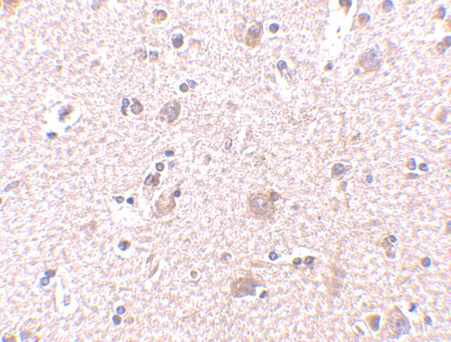 ARMET Antibody in Immunohistochemistry (Paraffin) (IHC (P))