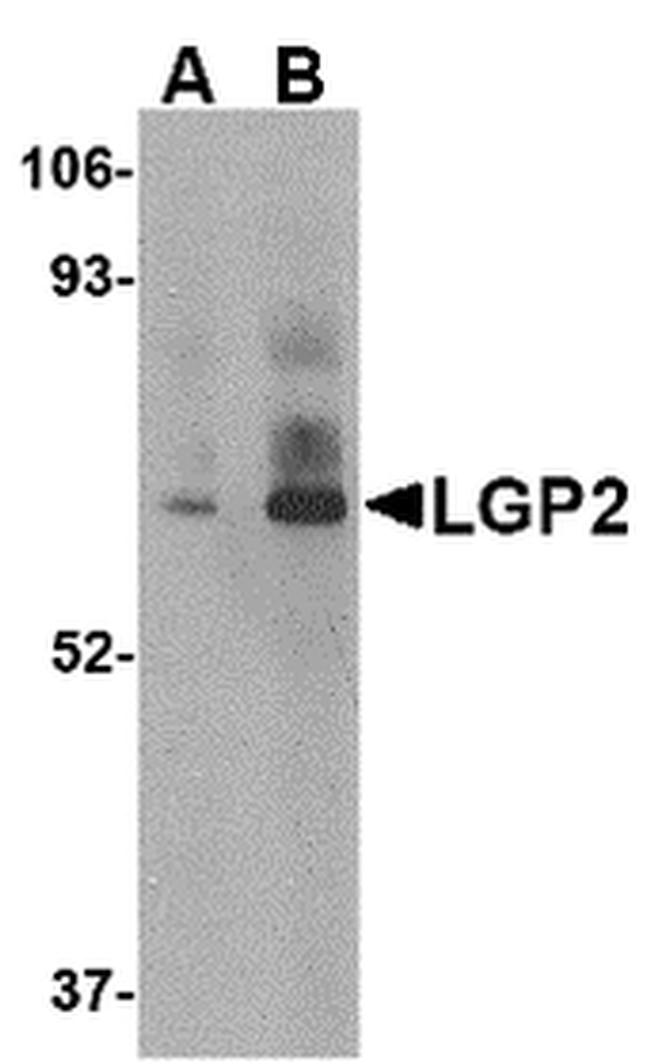 LGP2 Antibody in Western Blot (WB)