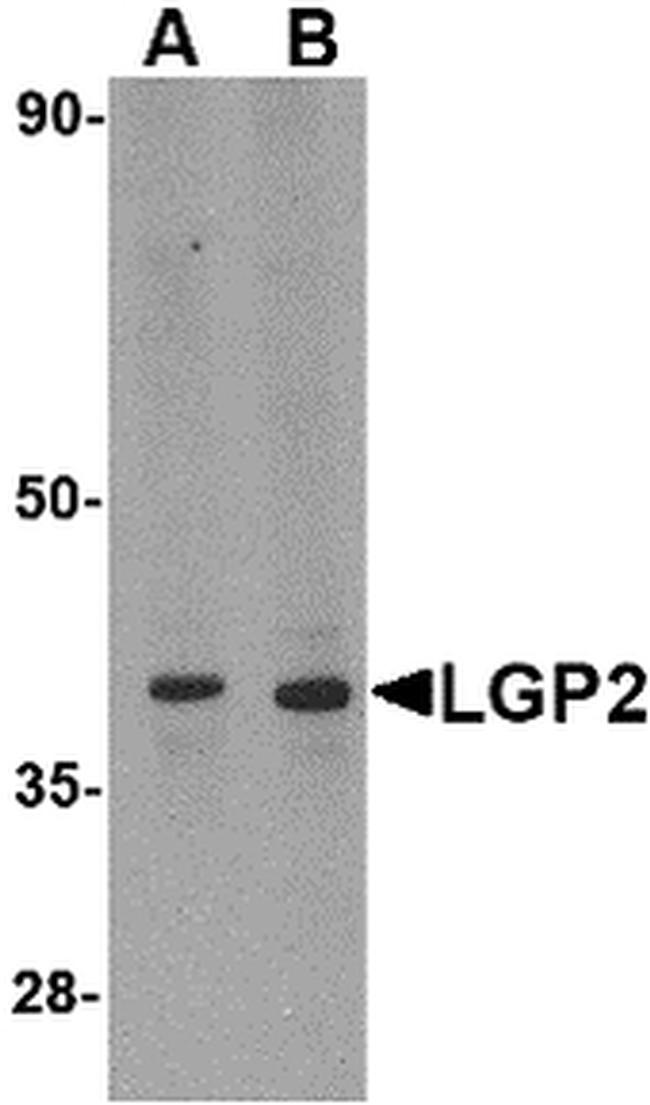 LGP2 Antibody in Western Blot (WB)