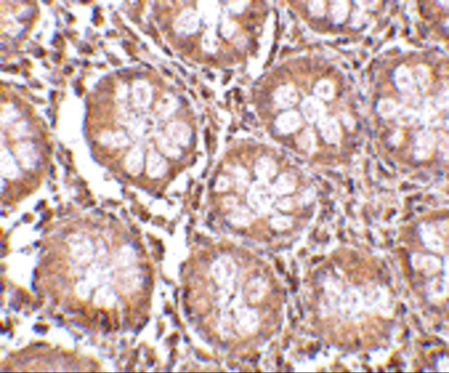 CD248 Antibody in Immunohistochemistry (Paraffin) (IHC (P))