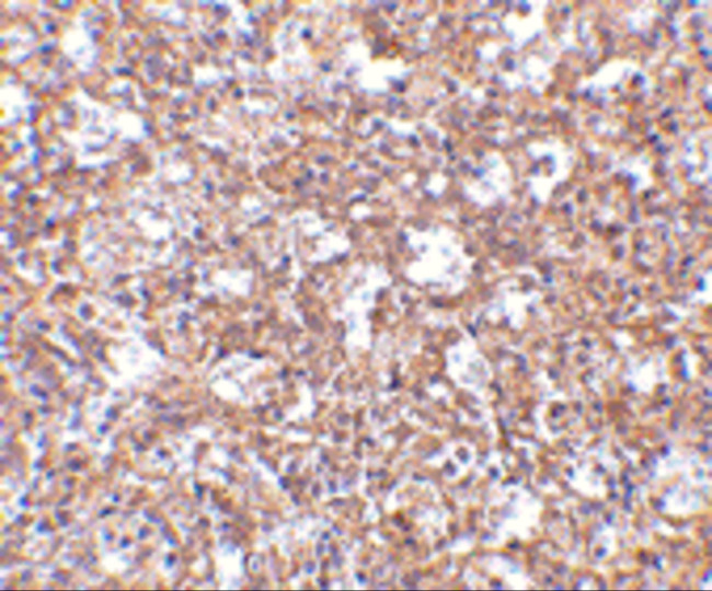 ARHGEF17 Antibody in Immunohistochemistry (IHC)
