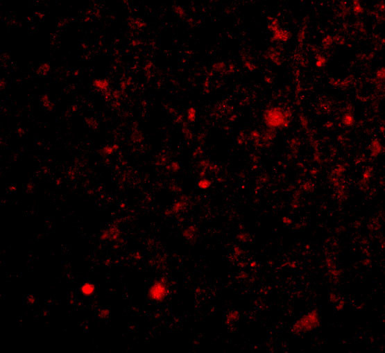 TOCA-1 Antibody in Immunocytochemistry (ICC/IF)